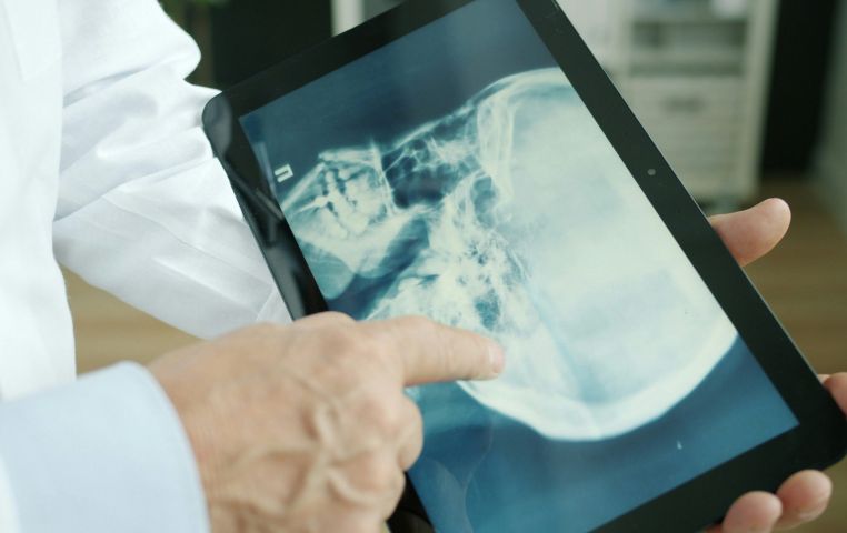 Digital X-ray